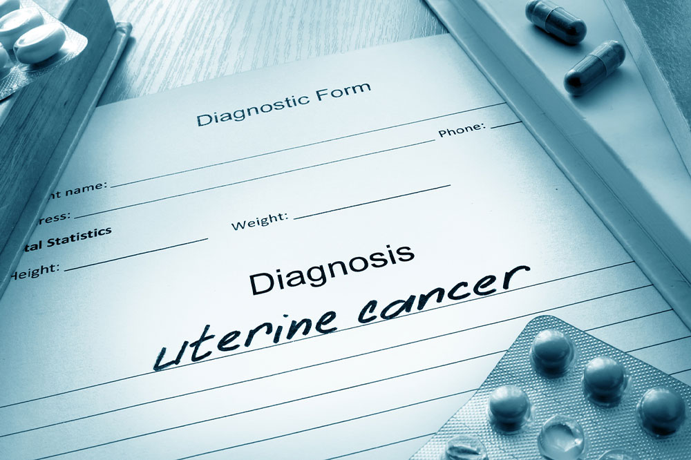 Uterine Cancer – Its Causes, Symptoms, and Stages